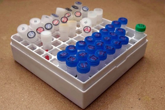 Onde Encontro Teste de Dna Ainda Gestante Serra da Cantareira - Teste de Dna Genética