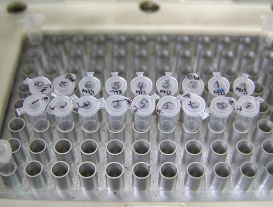 Quanto Custa Teste Dna Rápido Higienópolis - Dna em Grávida