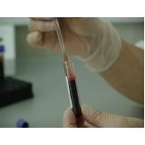 laboratórios para exame de paternidade intra uterino Votuporanga 