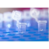 onde encontro laboratório para exame de dna com a saliva Guararema