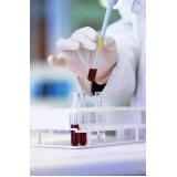 sexagem fetal kit valor Vila Maria