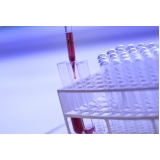 sexagem fetal laboratório valor Itatiba 